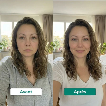 Résultat avant après 1